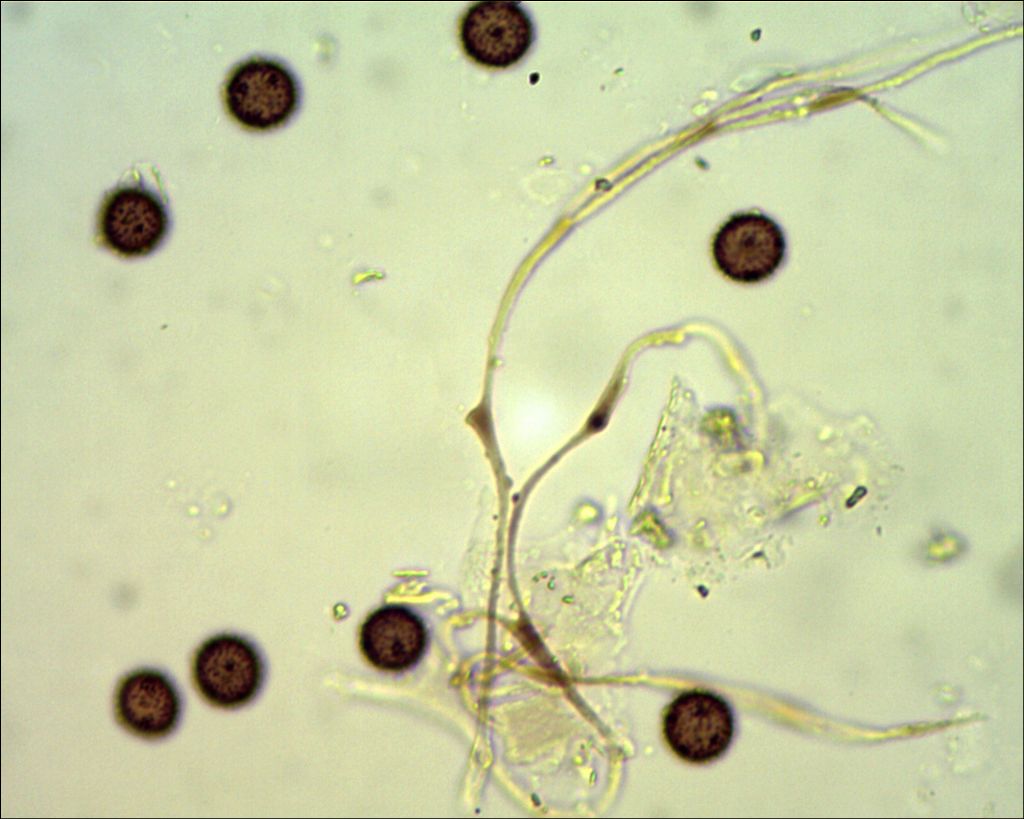 Didymium cf balearicum